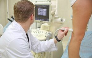 Methods for the treatment of varicose veins in the legs in women