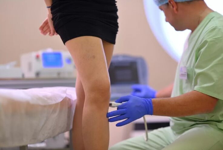 Ultrasound diagnosis of varicose veins. 